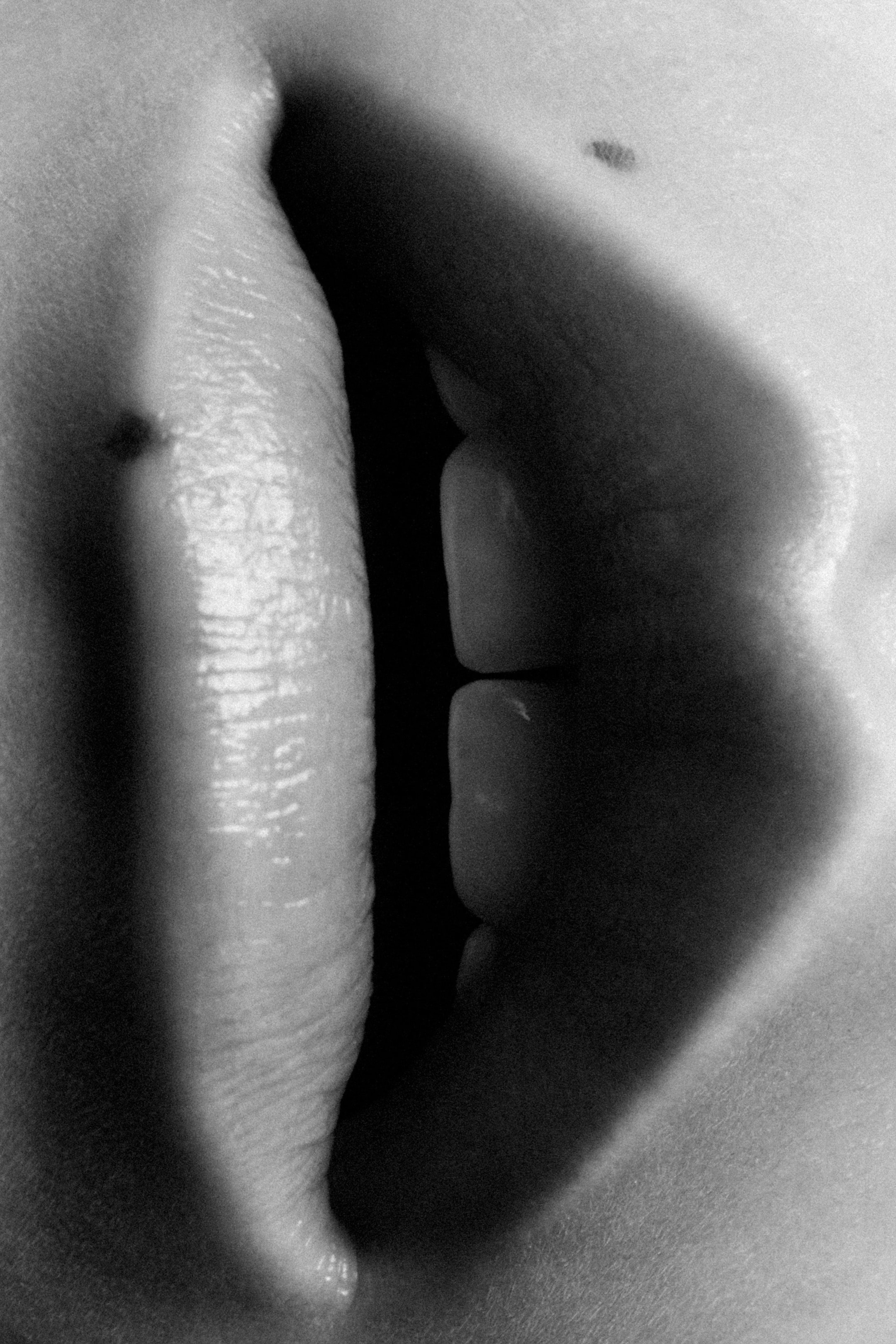 Close-up of a person's lips and teeth in black and white, with a distinct mole above the upper lip.